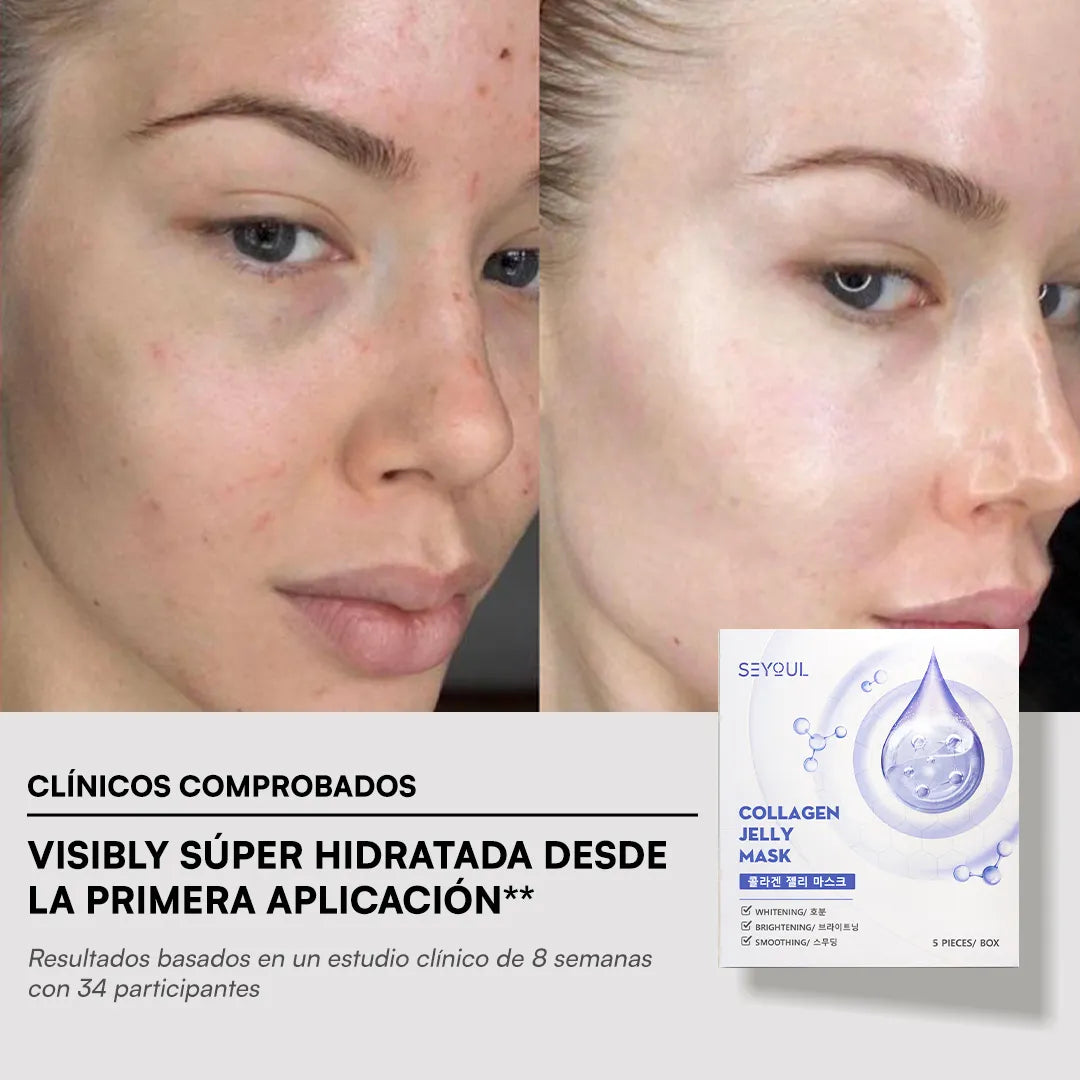 Mascarilla de Gelatina