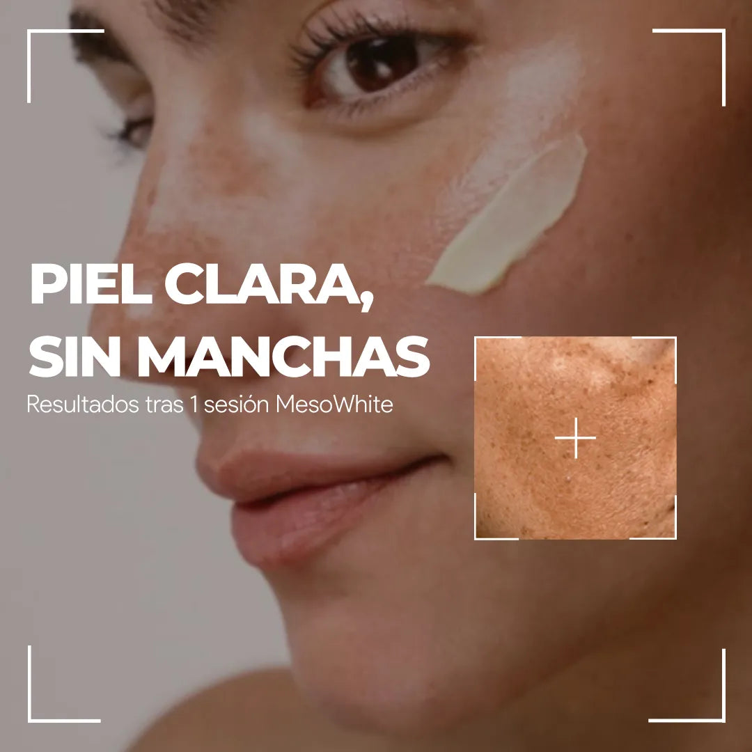 Células madre Mesowhite